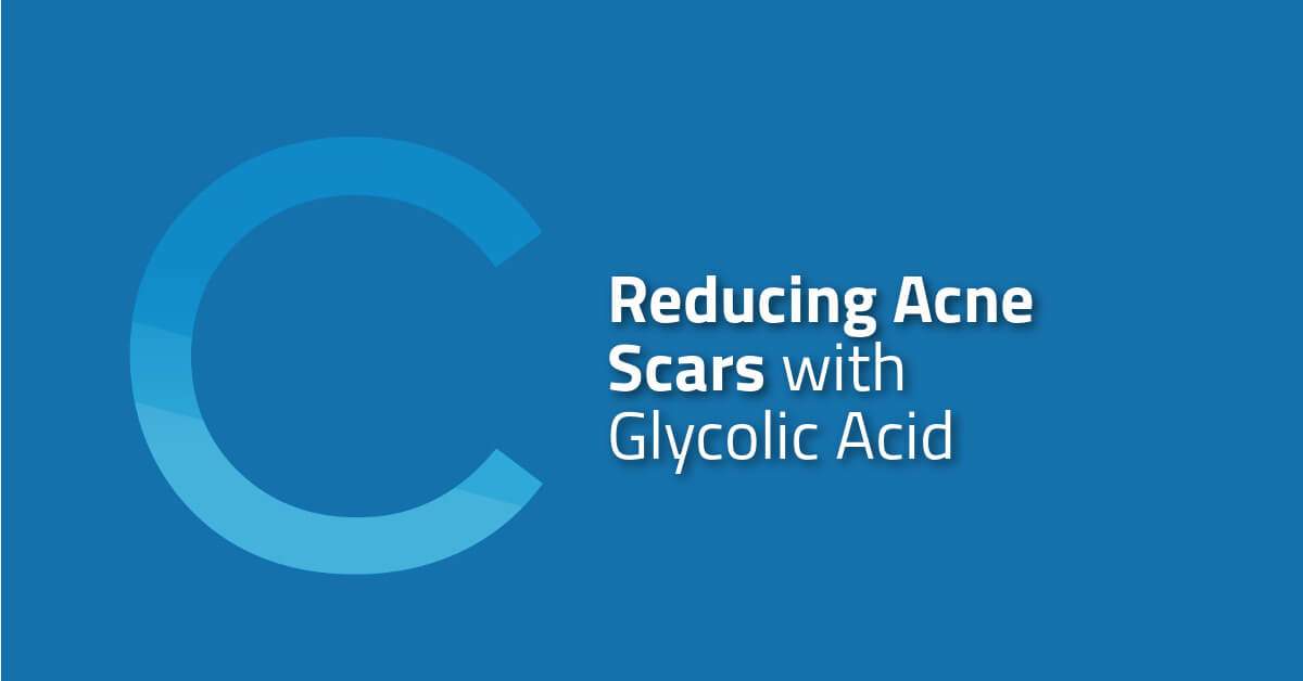 Reducing Acne Scars