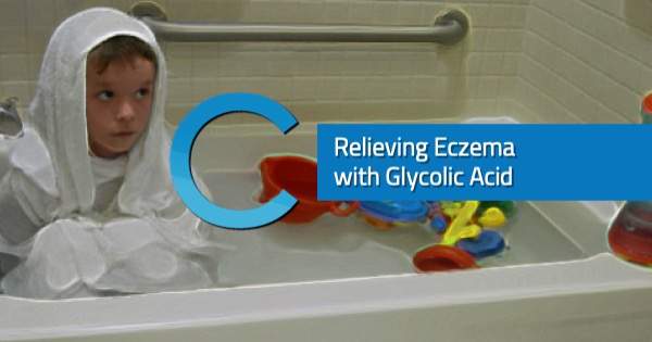 Relieving Eczema Glycolic Acid