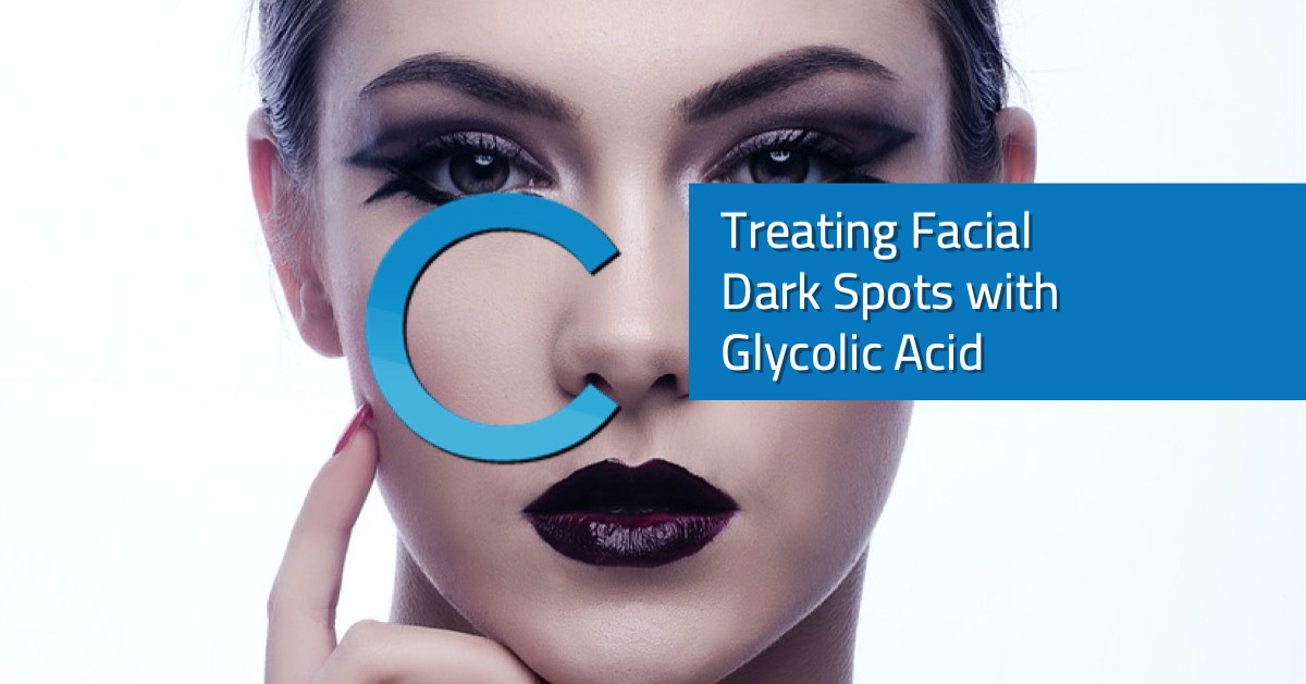 Treating Facial Dark Spots with Glycolic Acid