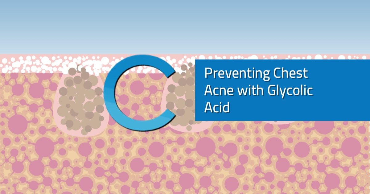 Preventing Chest Acne with Glycolic Acid