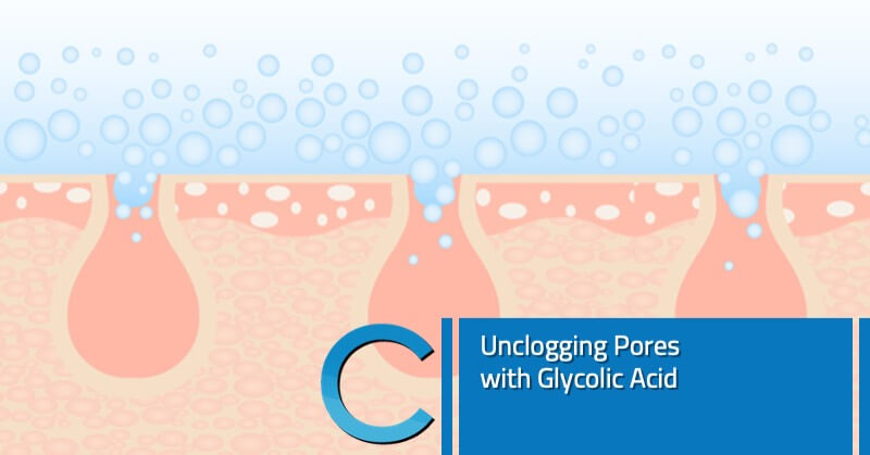 Unclogging Pores with Glycolic Acid