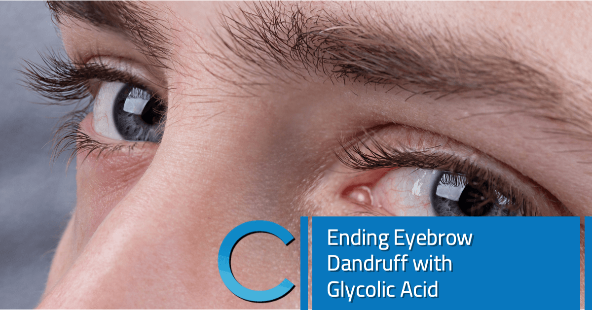 Ending Eyebrow Dandruff with Glycolic Acid