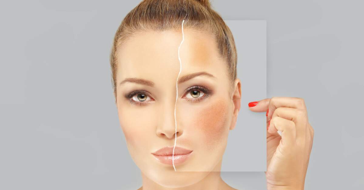 AtHome Glycolic Acid Peels Coast Southwest